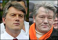 Viktor Andriiovych Yushchenko, former president of Ukraine, face scarred from dioxin poisoning from Vladimir Putin