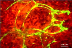 Mouse tissue sample with normal cells glowing green and cancer cells glowing red under ultraviolet light