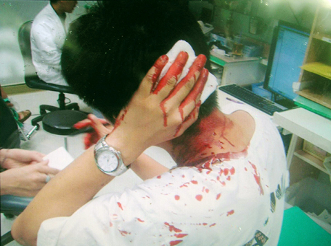 Taiwanese who protested against Chen Yunlin (Communist China's negotiator) beaten by KMT-controlled Taiwanese police