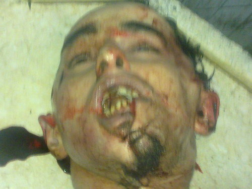 Khaled Said's face after being horribly beaten and mangled. Said was murdered in June 2010 by the Egyptian Mubarak regime.